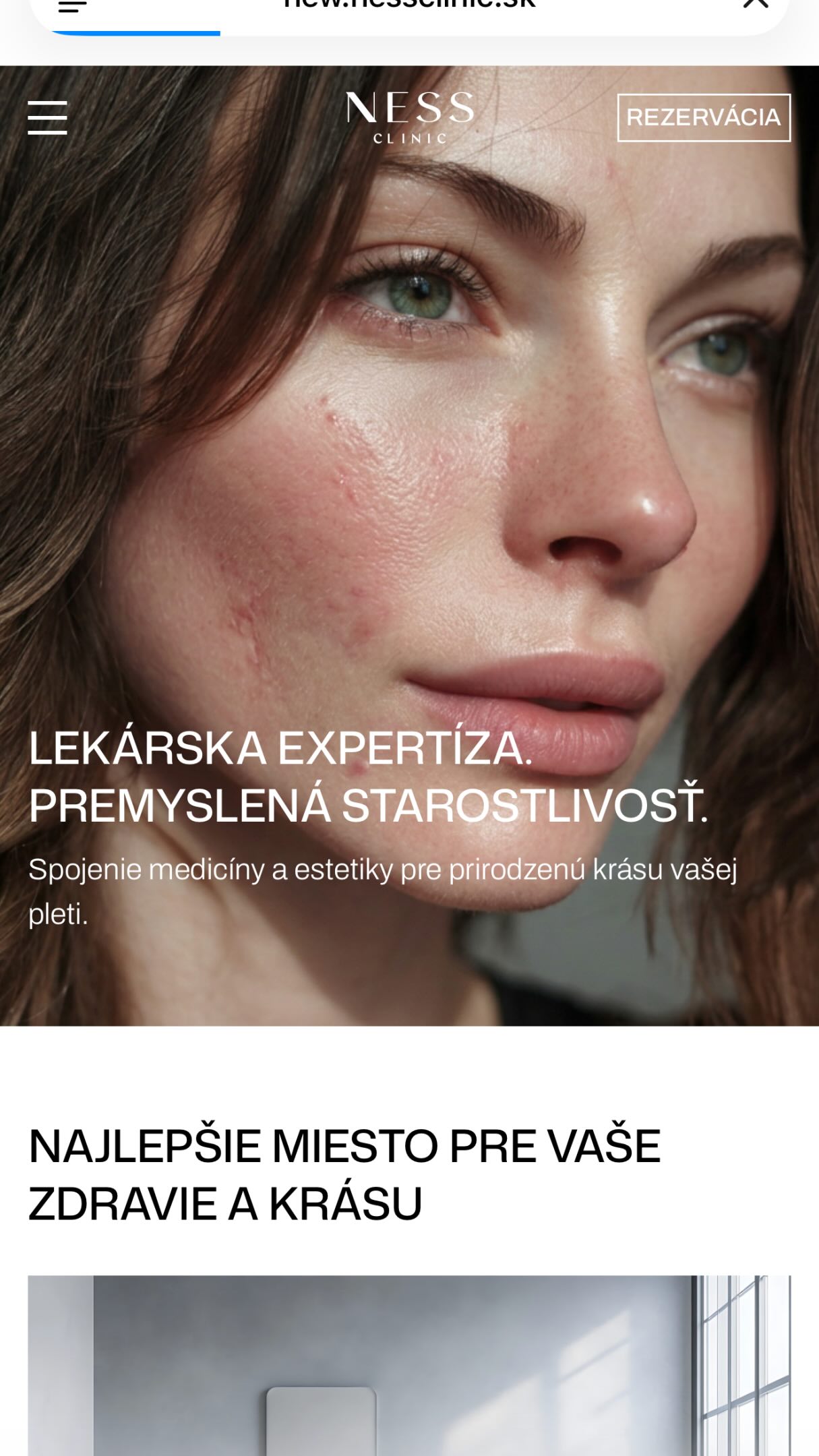 NOVÝ WEB! Nový online priestor, rovnaká starostlivosť o vás — nessclinic.sk